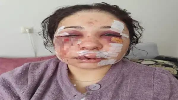 Boşanma aşamasındaki eşini darbeden polis memuru tahliye edildi