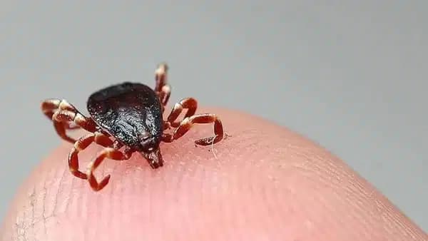 Çorum'da KKKA şüphesiyle tedavi gören kadın hayatını kaybetti